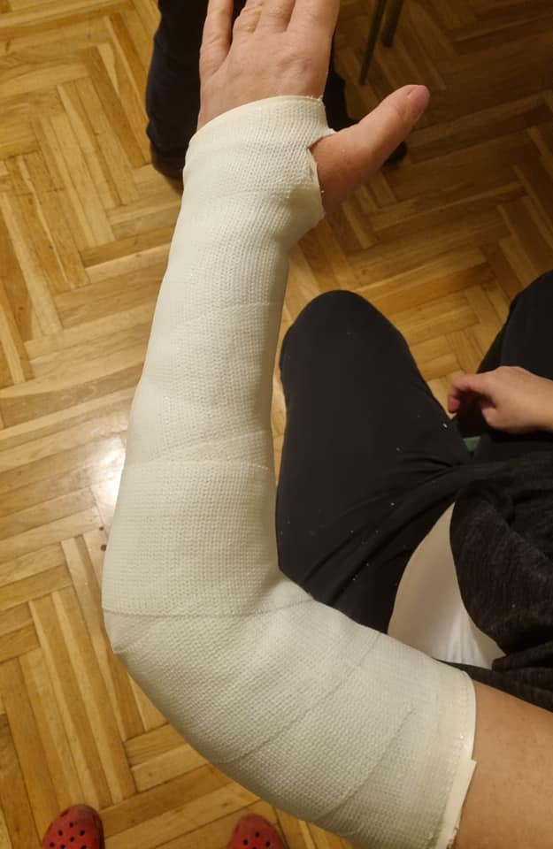 NADLAKTIČNI PLASTIČNI GIPS