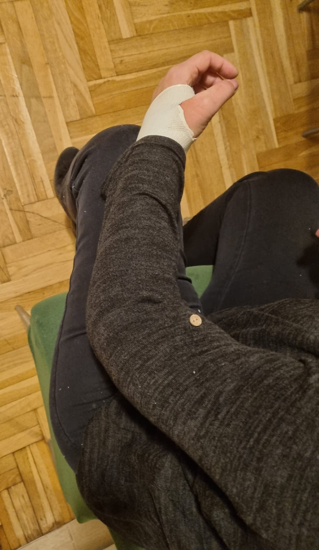 RUKA U PLASTIČNOM GIPSU, moguće je obući rastezlivu odjeću