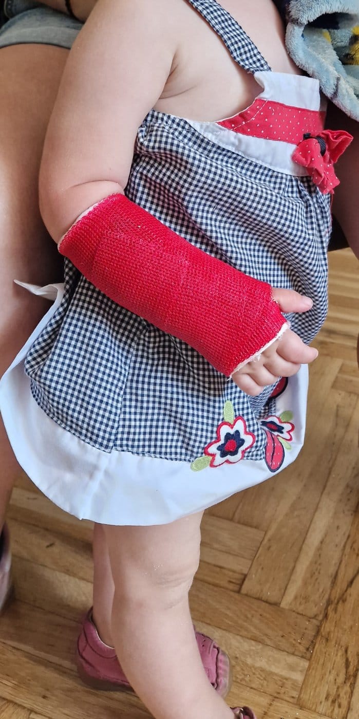 Plastični gips za djecu 